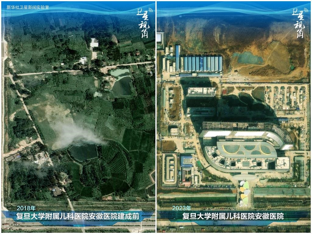 2023年與2018年相比，復(fù)旦大學(xué)附屬兒科醫(yī)院安徽醫(yī)院從一片荒地到建成投用。該項(xiàng)目是安徽省在長三角一體化高質(zhì)量發(fā)展衛(wèi)生健康領(lǐng)域的重大項(xiàng)目，也是安徽首批落地的國家區(qū)域醫(yī)療中心。